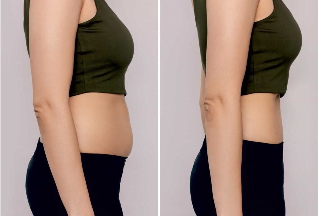 contouring and skin tightening scaled 1.jpg