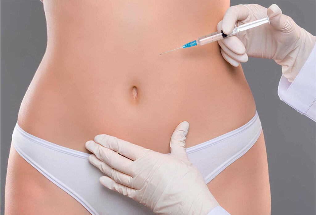 mesolipolysis scaled 1.jpg