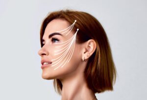 thread lifting scaled 1.jpg